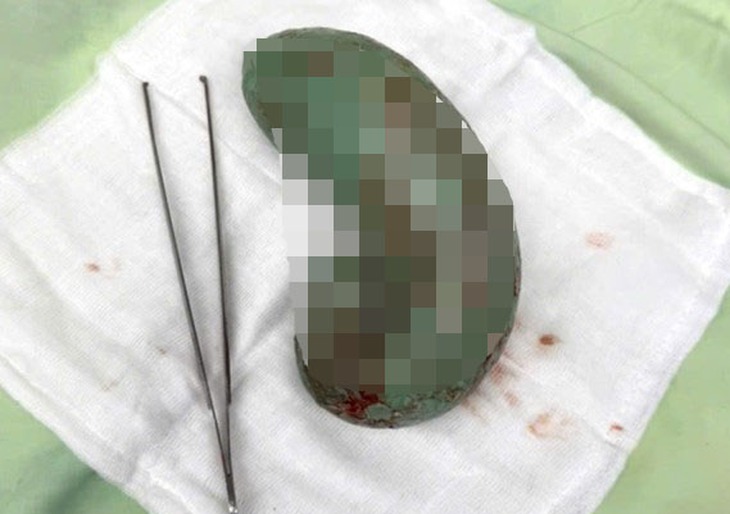 kẹo cao su - Ảnh 1.