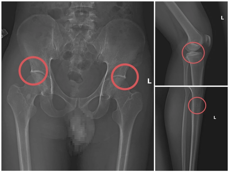 bảo hiểm - Ảnh 1.