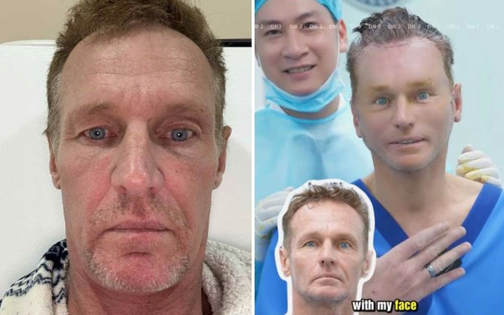 Cách làm 'giường khoai tây': trào lưu giúp nhiều bạn trẻ ngủ ngon - Ảnh 3.