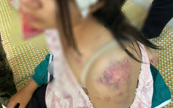 Bà nội, ông dượng, anh trai của bà nội đánh đập cháu gái gần 4 giờ đồng hồ - Ảnh 5.