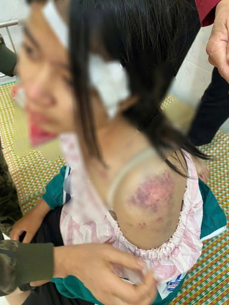 đánh đập - Ảnh 2.