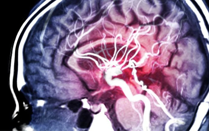 Cắt giảm bao nhiêu calo để làm chậm tiến trình lão hóa não? - Ảnh 2.