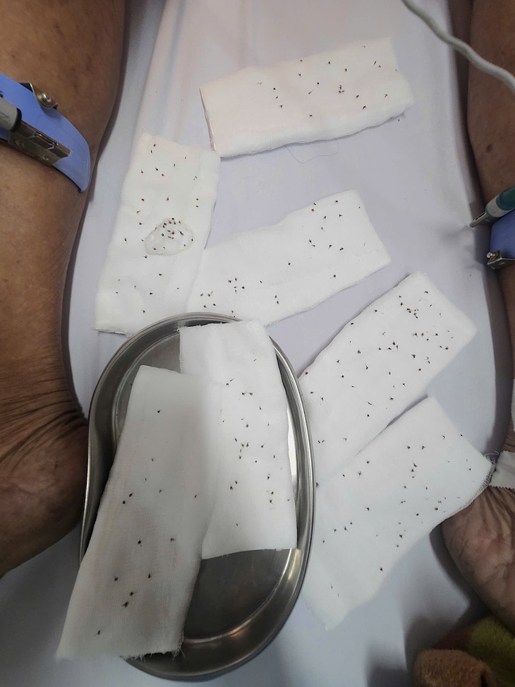 Người đàn ông 74 tuổi bị ong đốt hơn 100 vết được cứu sống kịp thời - Ảnh 3.