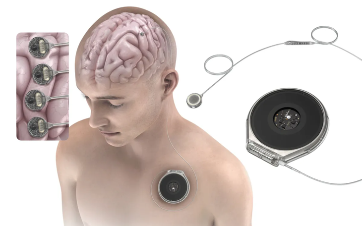 Startup Trung Quốc giới thiệu công nghệ điều khiển robot bằng suy nghĩ - Ảnh 2.