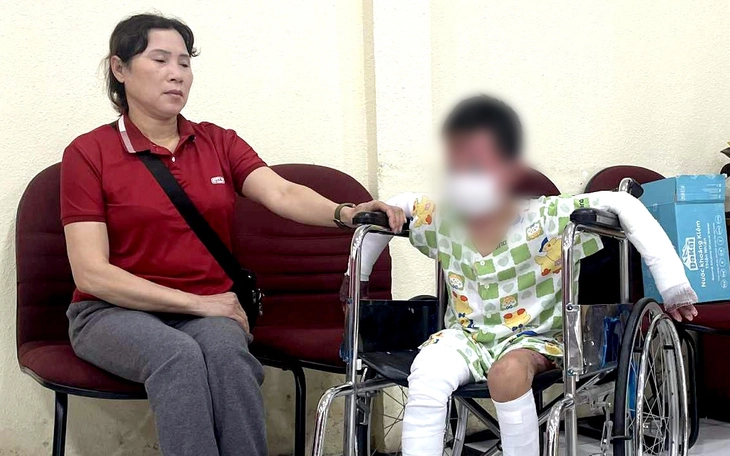 Hai người phỏng nặng khi dùng bình gas làm thịt chó - Ảnh 2.