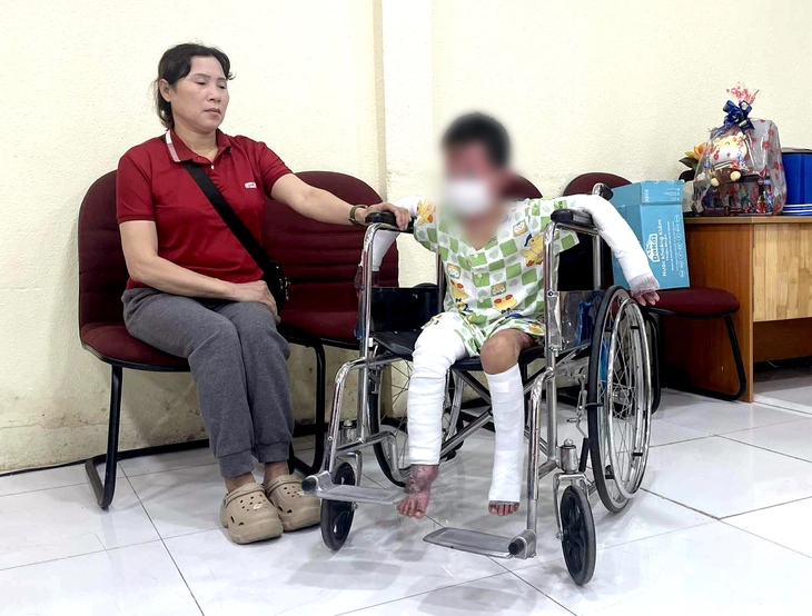 Cứu bệnh nhi phỏng 65% cơ thể trong vụ phóng hỏa ở Gia Lai làm 2 người tử vong - Ảnh 1.