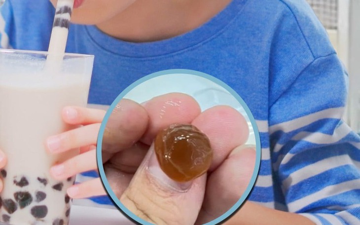 Cứu bé trai 16 tháng tuổi tím tái, suy hô hấp vì hóc hạt chôm chôm - Ảnh 3.