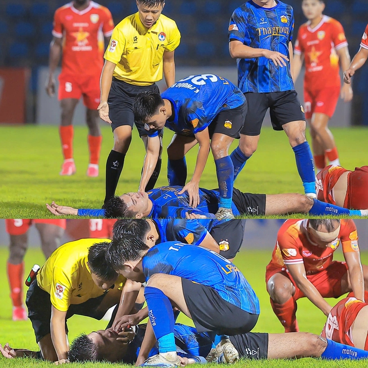 cắn lưỡi - Ảnh 1.