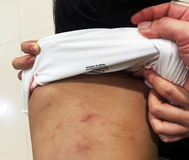 Công an vào cuộc vụ cô giáo đánh bé 2 tuổi ở Cà Mau- Ảnh 1. Công an vào cuộc vụ cô giáo đánh bé 2 tuổi ở Cà Mau - Ảnh 1.