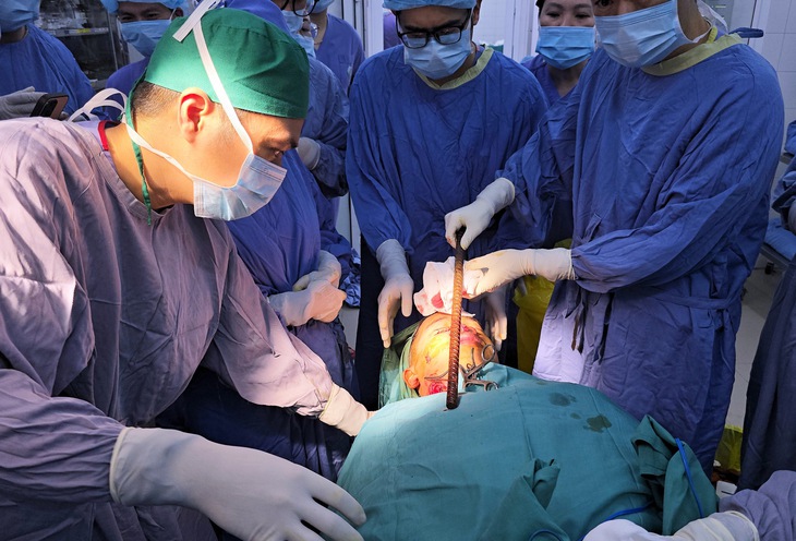 xuyên mặt - Ảnh 1.