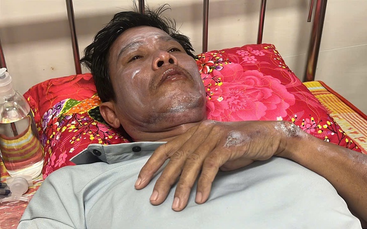 48 giờ trôi qua bão biển và sống sót thần kỳ: 5 lần thấy tàu, cố bơi lại cầu cứu - Ảnh 3.