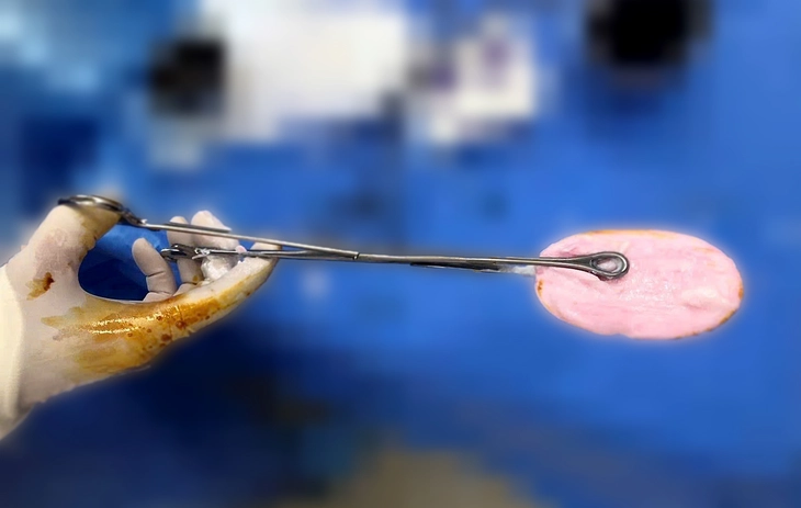 Bác sĩ cảnh báo xu hướng đáng lo gia tăng ở nhóm trẻ gái 10-16 tuổi - Ảnh 1.