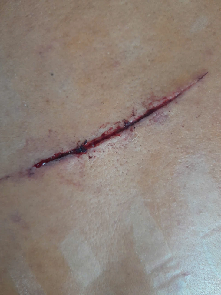 Dân 'tố' bị giang hồ hành hung, bao chiếm mặt biển, công an vào cuộc điều tra - Ảnh 3.