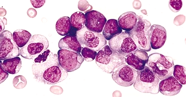 Cuộc chiến trường kỳ chống ung thư - Kỳ 3: Thử nghiệm liệu pháp nhắm trúng đích - Ảnh 3.