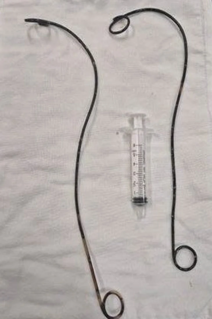 Ống thông - Ảnh 2.