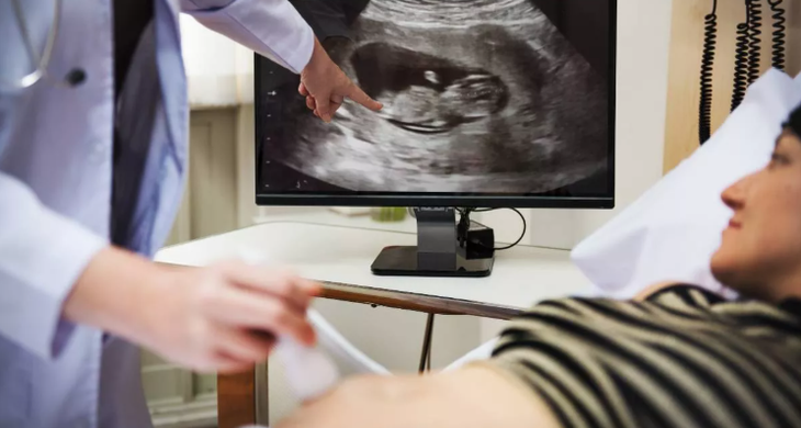 Siêu âm tim thai - Ảnh 2.