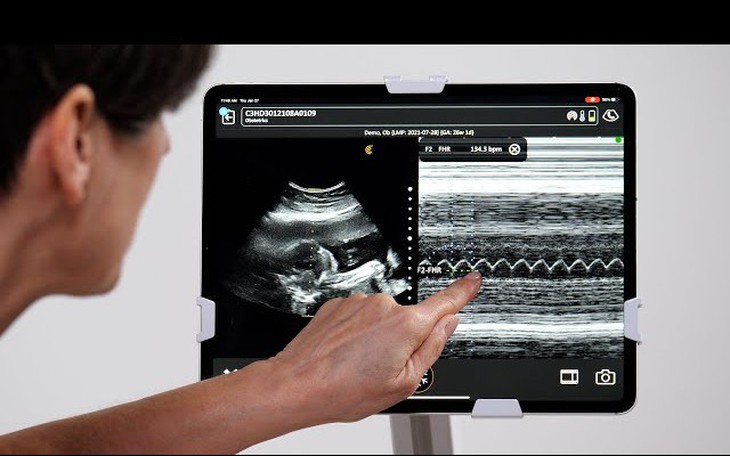 Israel phát triển thiết bị cầm tay giúp mẹ bầu tự siêu âm tại nhà - Ảnh 2.