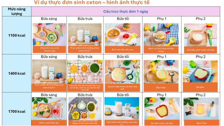 động kinh - Ảnh 3.