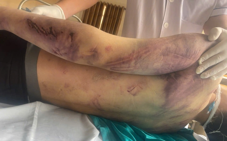 Học viên Trung tâm CTXH Hải Hà bị đánh chết sau 2 ngày nhập học: Tạm dừng hoạt động trung tâm - Ảnh 2.