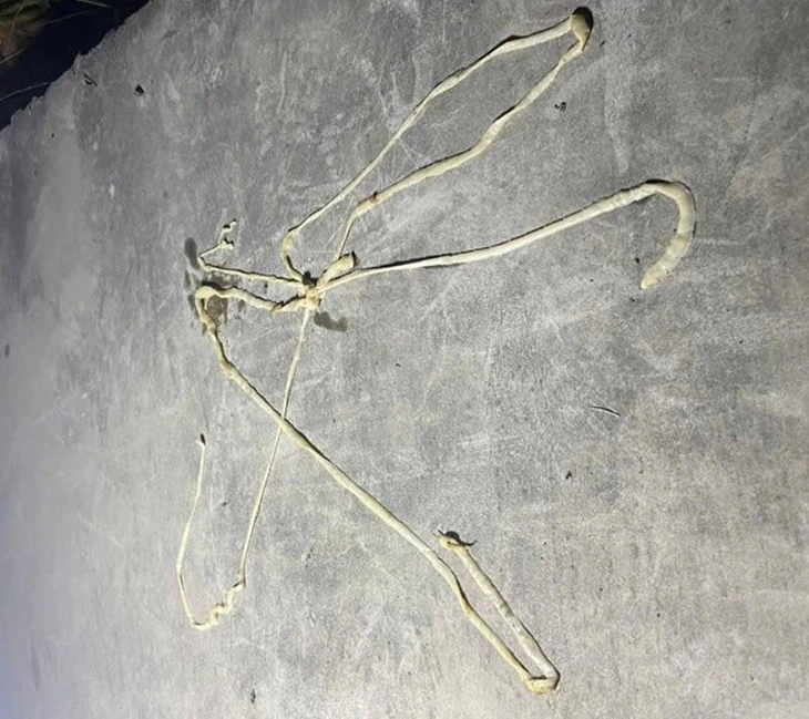 sán lợn - Ảnh 2.