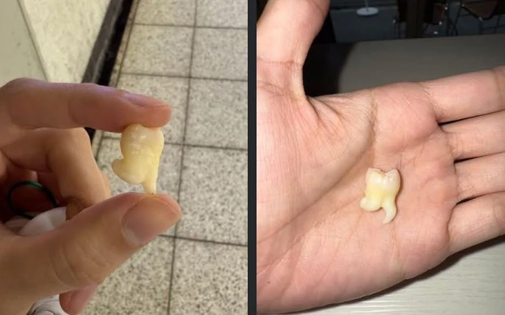 "Vuýp" là gì mà xuất hiện đầy trên mạng xã hội? - Ảnh 5.