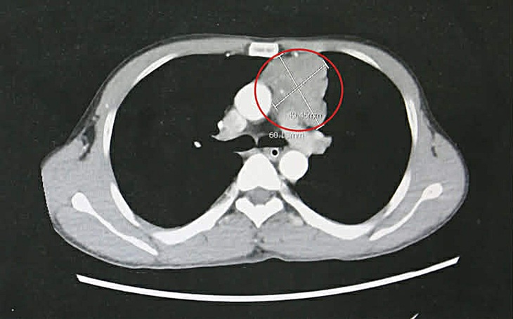 nhược cơ - Ảnh 3.