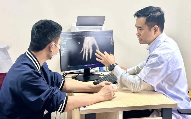 Nối liền bàn tay gần đứt rời cho bệnh nhi 2 tuổi do máy dập cốc - Ảnh 2.