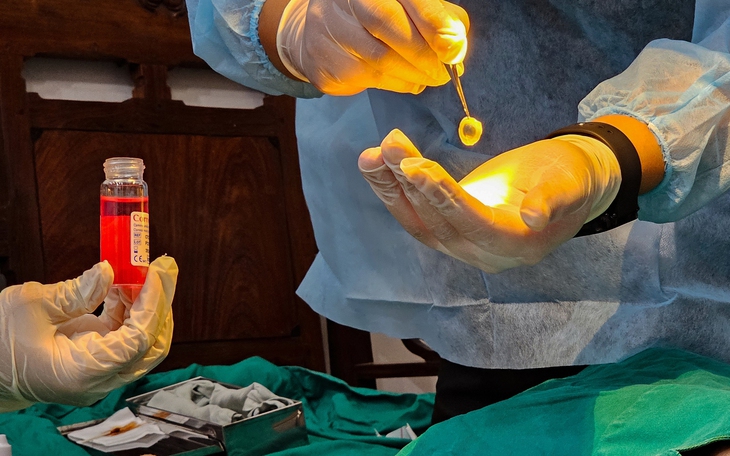 Qua đời vì ung thư, cô gái trẻ hiến giác mạc trao ánh sáng cho hai cuộc đời - Ảnh 4.