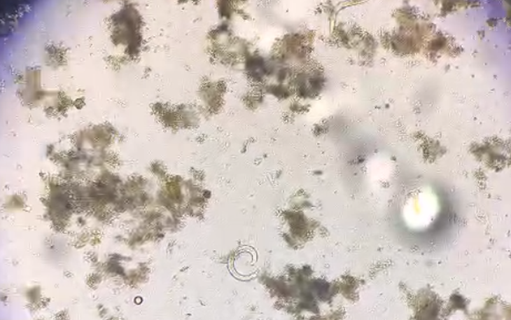 Giun lươn nguy hiểm nhưng bị lãng quên - Ảnh 3.