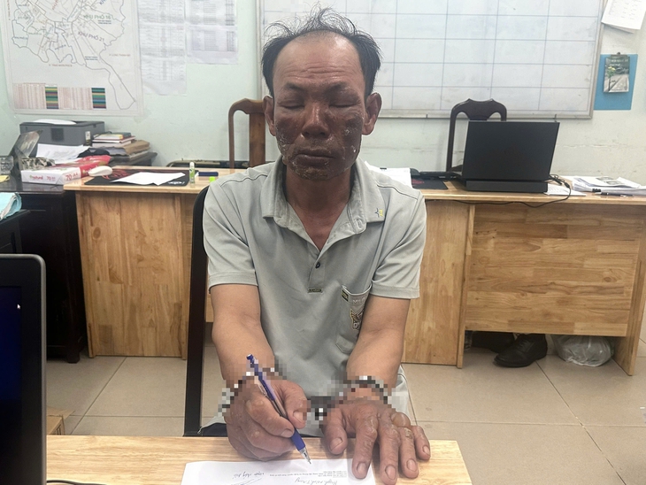 phóng hỏa - Ảnh 2.