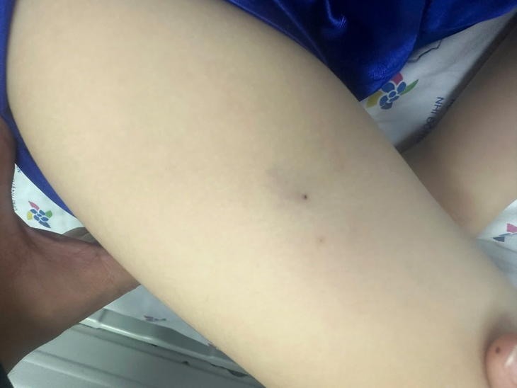 ong đốt - Ảnh 1.