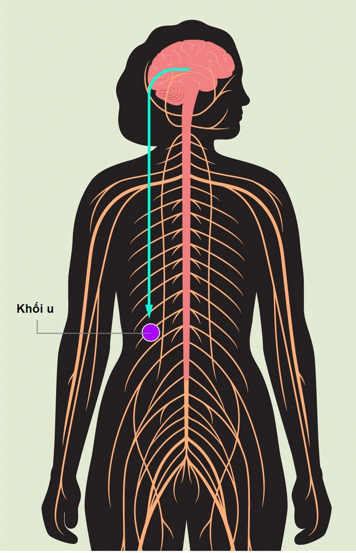 u - Ảnh 1.