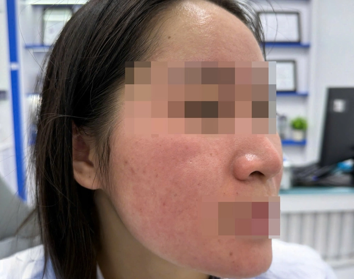 Hết trị bách bệnh, lại đến dùng nước cốt chanh trị mụn - Ảnh 1. nước cốt chanh - Ảnh 1.