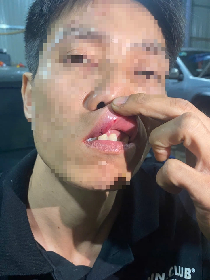 xông vào nhà - Ảnh 2.