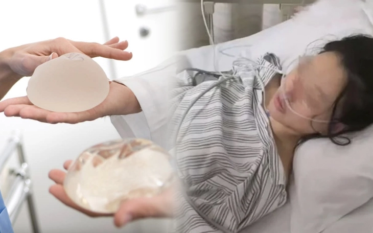 Khu du lịch tuyển 'người rừng' lương 2 triệu/ngày - Ảnh 3.
