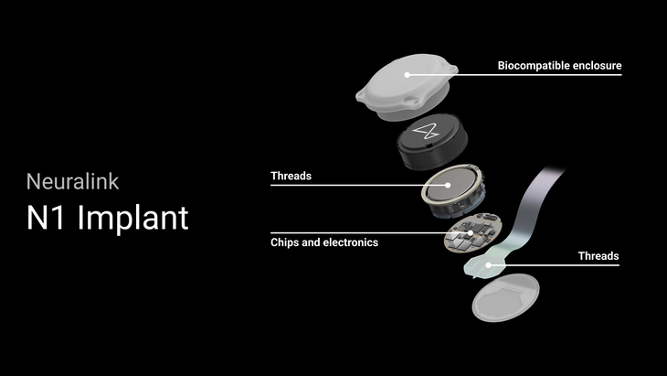 Neuralink: Điều khiển máy tính bằng não và hy vọng cho người mù - Ảnh 1.