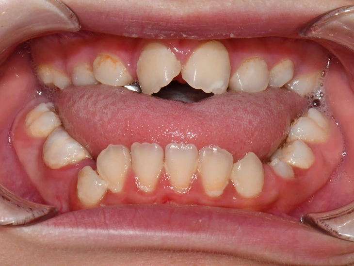 di truyền - Ảnh 1.