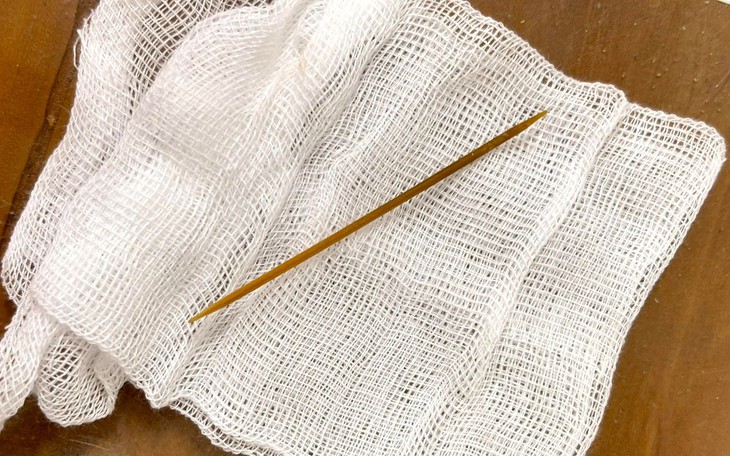 Nuốt que xiên nhỏ gây hậu quả lớn - Ảnh 2.