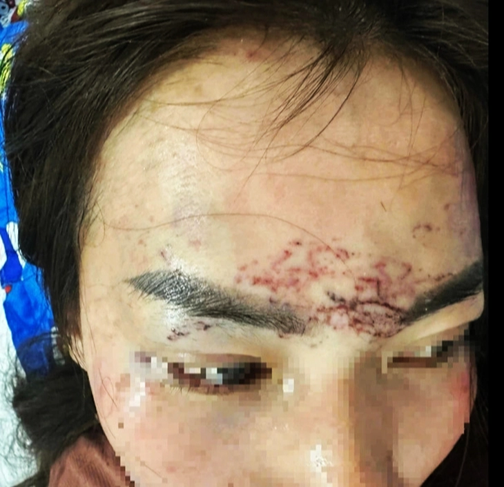 ĐÁNH GHEN - Ảnh 1.