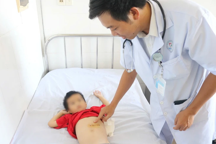 Phẫu thuật gắp búi tóc nặng nửa ký khỏi dạ dày bệnh nhi 5 tuổi- Ảnh 1. Phẫu thuật lấy búi tóc nặng nửa ký khỏi dạ dày bệnh nhi 5 tuổi - Ảnh 1.