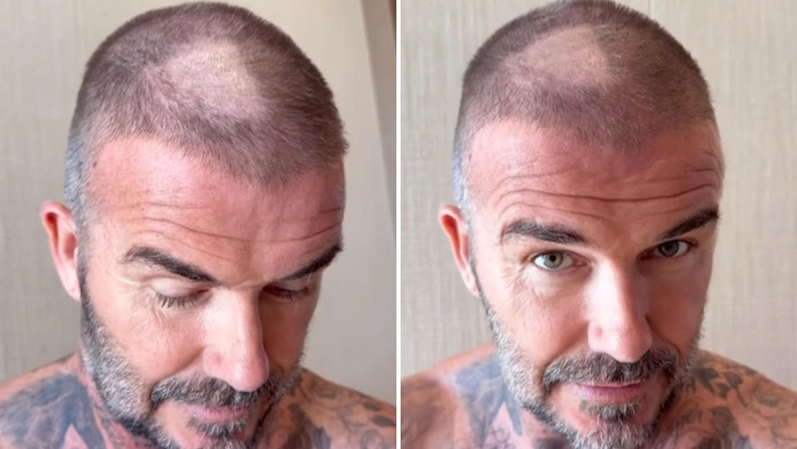 Beckham - Ảnh 1.