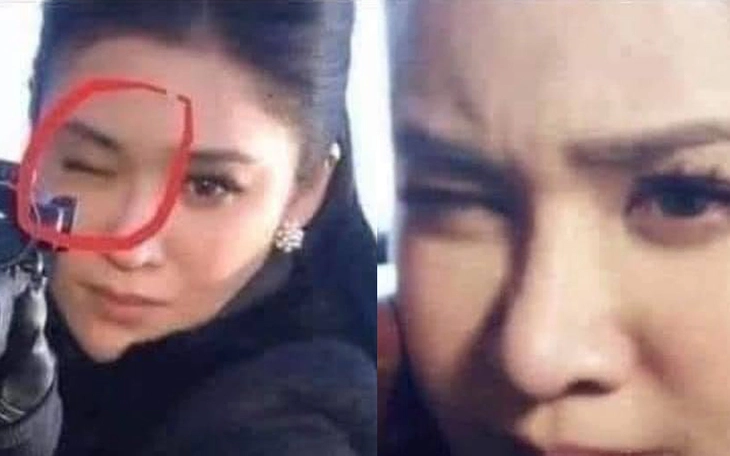 'Sợi chỉ đỏ mọc trên đầu' tràn ngập cõi mạng có ý nghĩa gì?  - Ảnh 4.