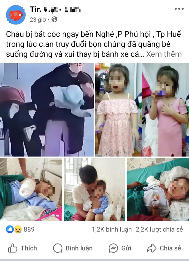 Tin trẻ em bị bắt cóc rồi ném xuống đường bị xe đụng gãy tay là tin giả - Ảnh 1.