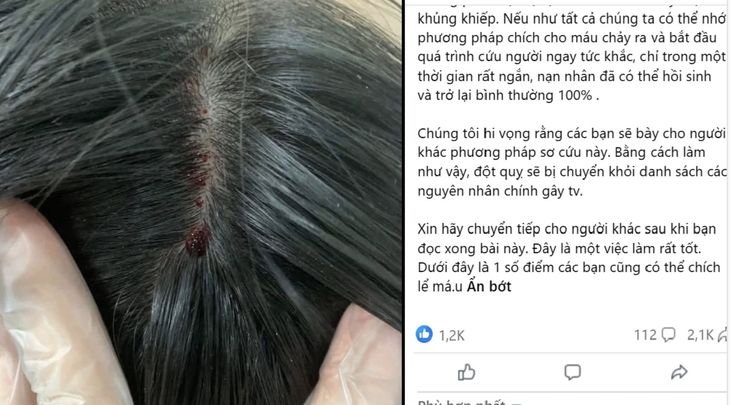 đột quỵ - Ảnh 1.