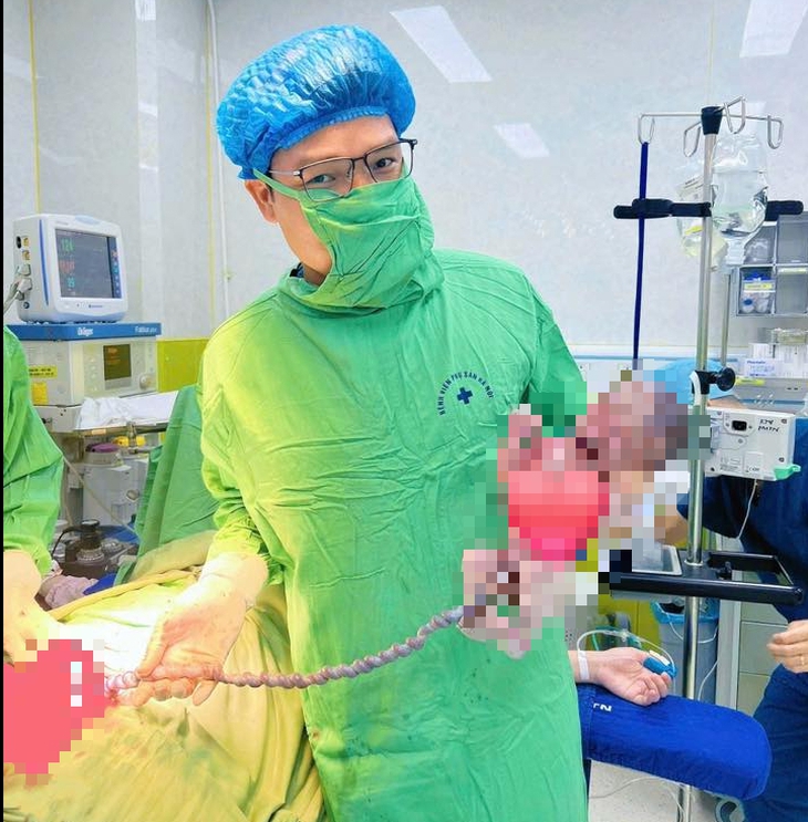 Bé gái có dây rốn dài 1m, xoắn vặn nhiều vòng - Ảnh 1.