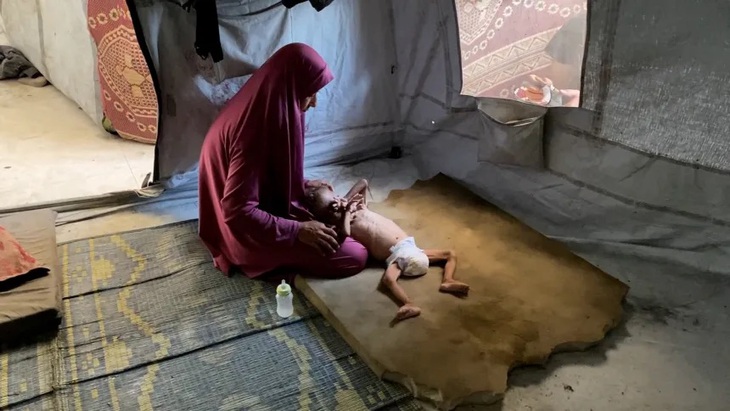 Bác sĩ ở Gaza ngất xỉu vì đói và kiệt sức trong lúc phẫu thuật - Ảnh 4.