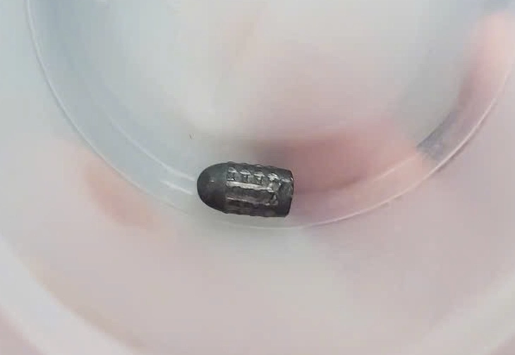 Đã tìm ra người bắn súng hơi khiến đạn lạc trúng đầu người phụ nữ làm vườn - Ảnh 1.