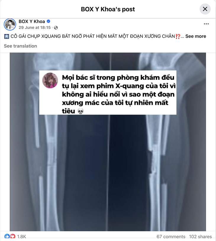 Cô gái chụp X-quang bất ngờ thấy mất xương chân - Ảnh 1. chụp X-quang - Ảnh 1.