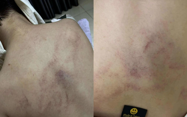 Cháu bé bị xuất huyết não bất thường ở điểm giữ trẻ tự phát, công an vào cuộc - Ảnh 3.