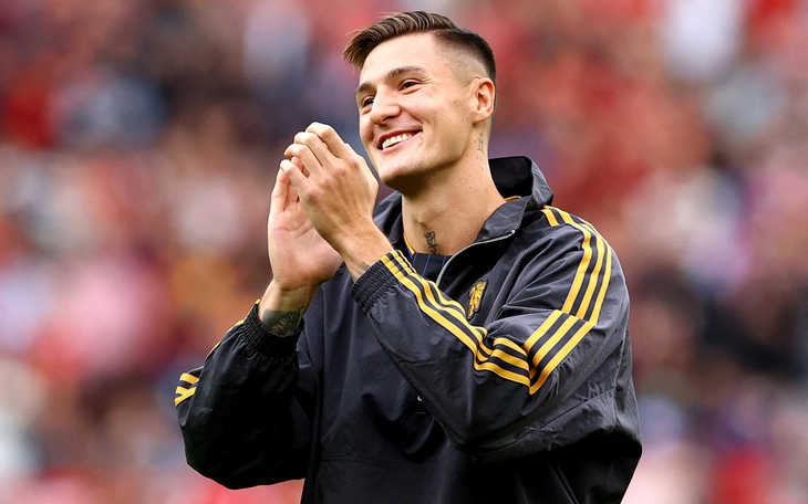 Cổ động viên trải qua 313 ngày chưa thể cắt tóc vì... Man United đá quá tệ  - Ảnh 2.